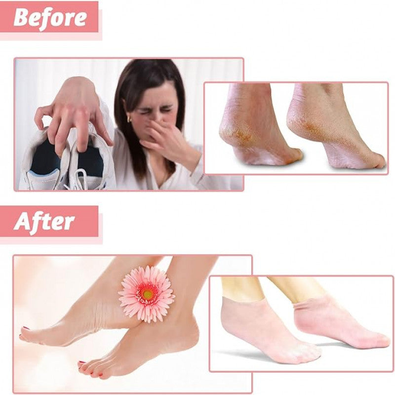 Silicone Moisturizing Soft Gel Socks